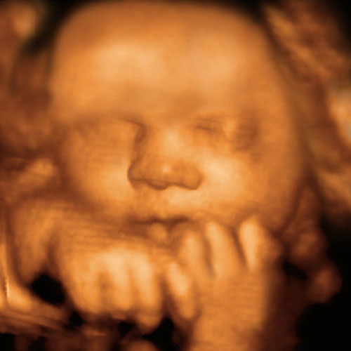 ultrasound 3d 4d uc pregnancy ucbaby