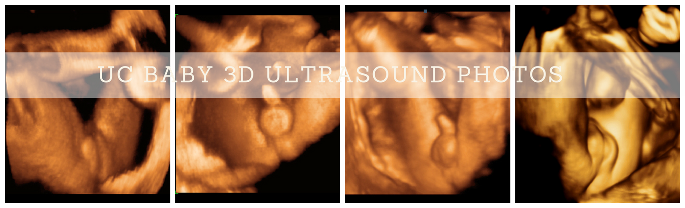 What You Need to Know about Ultrasounds for Sex Determination UC Baby
