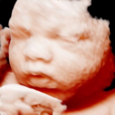 UC Baby HD Ultrasound