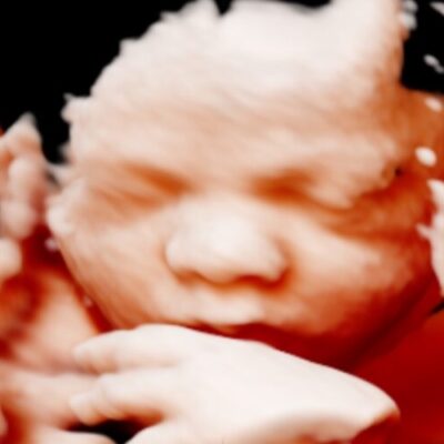 UC Baby 3D HD Ultrasound