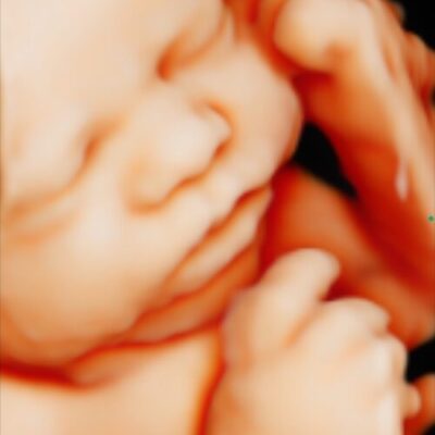 UC Baby 3D 5D Ultrasound