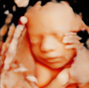 3D Ultrasound | 4D Ultrasound - Montreal, Quebec - UC Baby