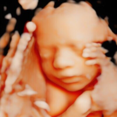 UC Baby 3D HD Ultrasound