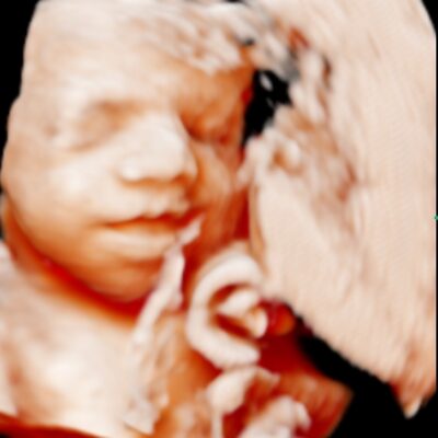 UC Baby 5d ultrasound