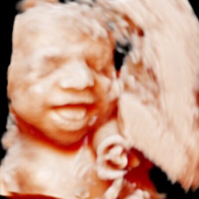 UC Baby 3D 5d Ultrasound