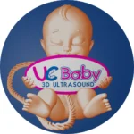 UC Baby 3D Ultrasound